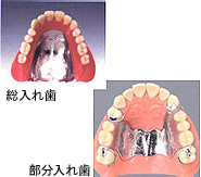 コバルト床