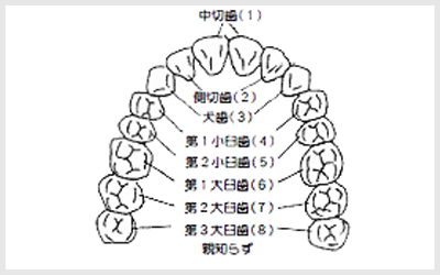 親知らずってなあに？