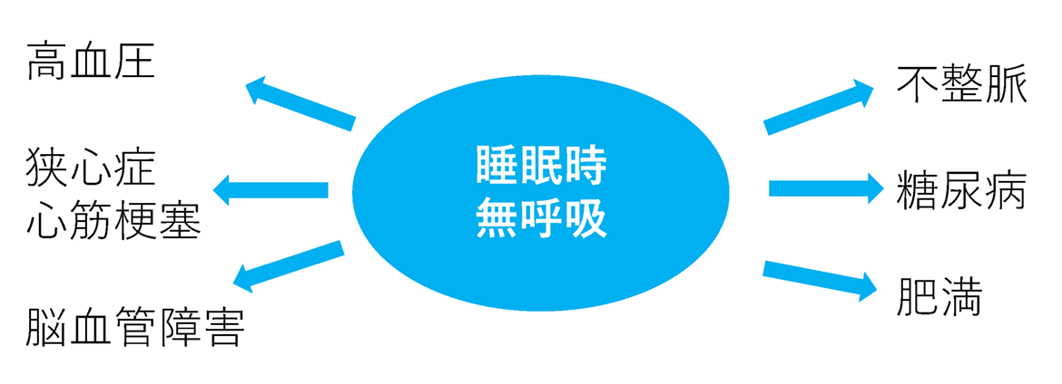 睡眠時無呼吸の治療に取り組む目的