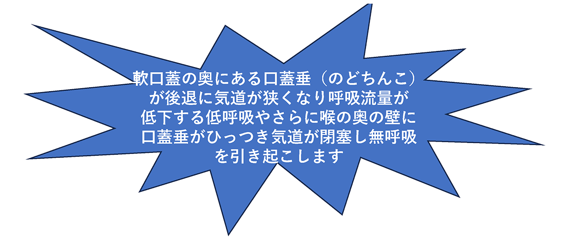 睡眠時無呼吸の病態