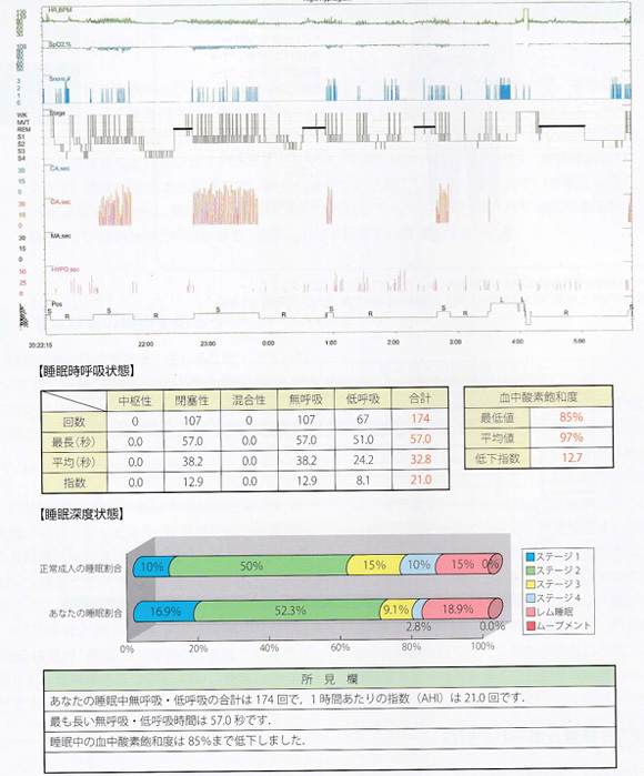 睡眠時無呼吸の診断