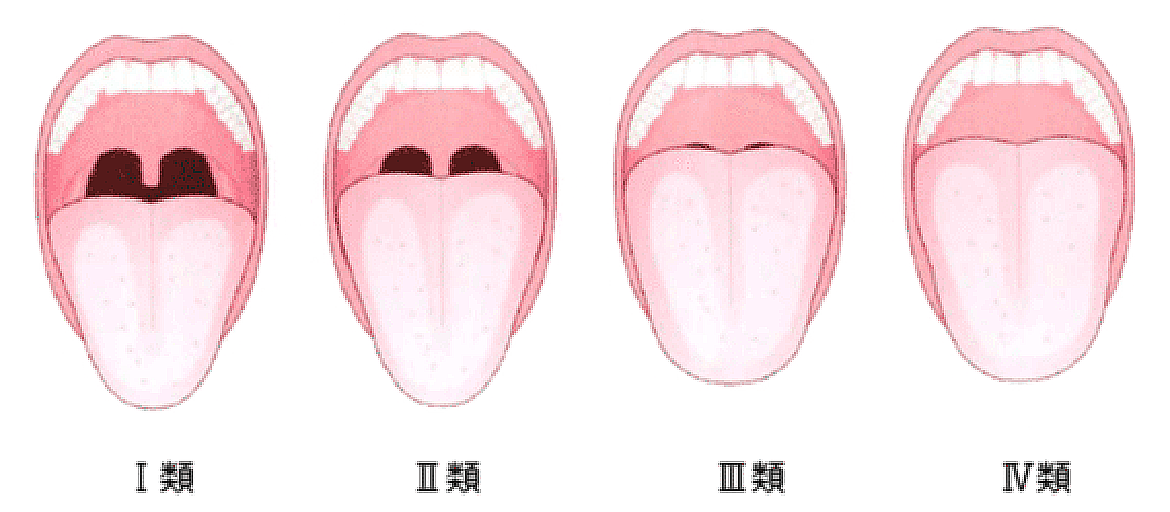 マランパチ分類